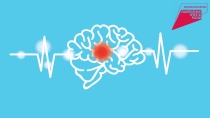 В России проходит Неделя борьбы с инсультом